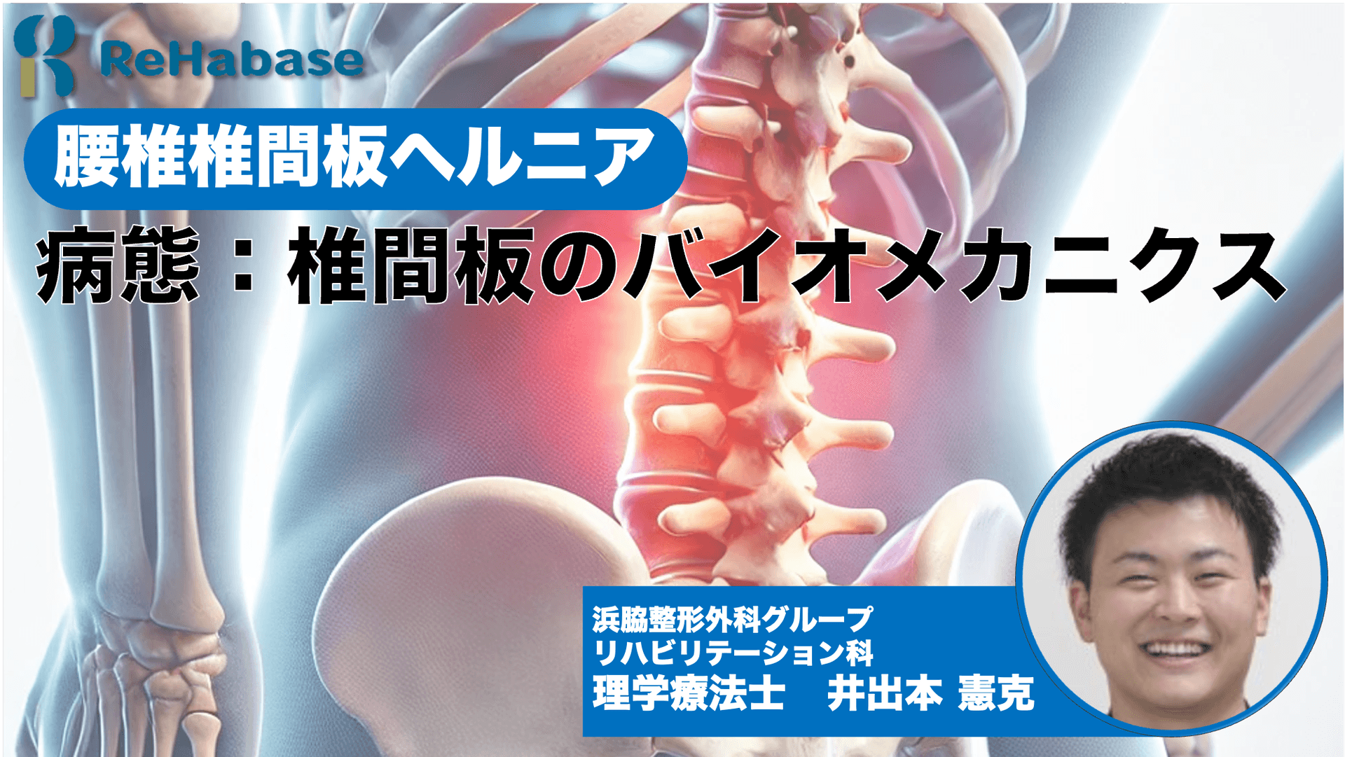 病態:椎間板のバイオメカニクス